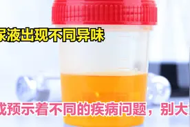 尿液出现不同异味，或是4类健康问题征兆，别不当回事视频封面