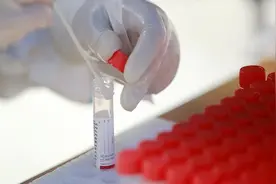 深圳昨日新增15例确诊病例和12例无症状感染者，详情公布视频封面