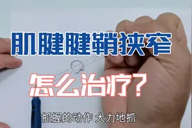 手指活动“卡顿、弹响”，可能是肌腱腱鞘狭窄，要怎么解决呢？视频封面