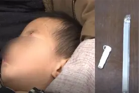 2岁男童被木棍戳伤左眼，粗心爸爸没在意，医生：严重可能失明视频封面