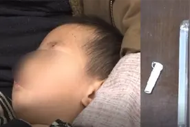 2岁男童被木棍戳伤左眼，粗心爸爸没在意，医生：严重可能失明视频封面