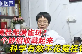 脸上长雀斑怎么办？中医教你3招淡化雀斑，不要花“冤枉钱”视频封面