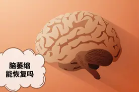 脑萎缩能恢复吗？听听医生给你支的这些招儿，可防止加重脑萎缩视频封面