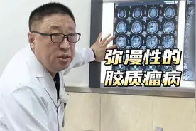 精神恍惚发现脑内多发病灶，疑似癌转移，医生：太弥漫只能活检视频封面