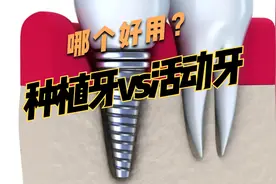 种植牙真的好吗？10年使用者：全口缺牙用活动假牙也挺好视频封面