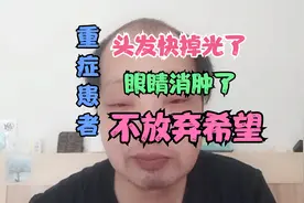 重症患者，头顶头发快掉光了，不过今天眼睛消肿了，不放弃希望！视频封面