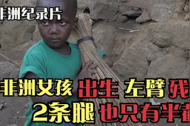 非洲女孩出生时左臂残疾，2条腿也只有半截，村民扬言要杀了她！视频封面