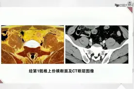 断层影像解剖学--六、盆部--6.2男性盆部与会阴视频封面