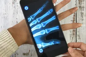 教你用手机开启CT“扫描仪”功能，手上的骨头都能看的一目了然视频封面