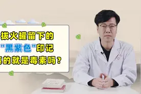 拔罐后留下的青紫印子，到底是湿毒还是淤血？中医回答了视频封面