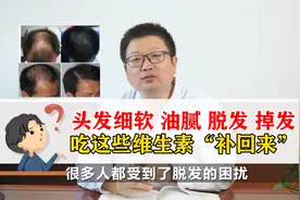 头发细软油腻脱发掉发，吃这些维生素补回来视频封面