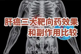 梳理|肝癌三大靶向药效果和副作用比较视频封面