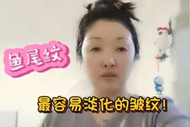 最容易淡化的皱纹|鱼尾纹！手法简单易学，紧致眼皮代谢眼袋浮肿