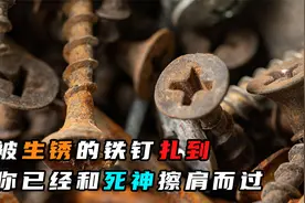 命大！被生锈的铁钉扎到不做处理，你已经和死神擦肩而过！视频封面