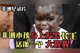 非洲小孩发黑长毛，村民侮辱她是大猩猩，出生被抛弃守屋子等死！视频封面