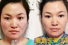 颧骨高、大小脸、牙齿整排偏斜、下巴偏斜、看用正骨手法怎么矫正视频封面