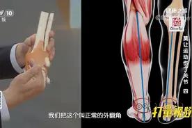 踮起脚尖看踝关节，出现内翻要注意了，听听专家的讲解|健康之路