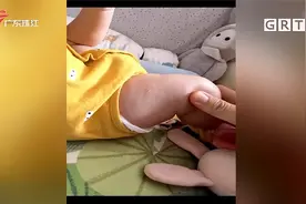 广州：医院做剖腹产手术 婴儿出生大腿有伤视频封面