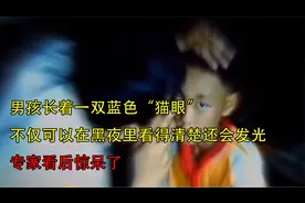 男孩长着一双蓝色眼睛，在晚上越黑看得越清楚，专家看后惊呆了视频封面