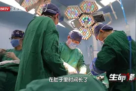 23厘米的巨大肿瘤已经生长到极限，医生们小心翼翼终于成功切除视频封面