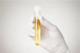 检测出尿微量白蛋白偏高是怎么回事？医生为你详解！视频封面