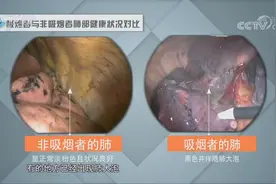 吸烟是致肺癌的首要因素，一个肺部对比视频让人触目惊心|人口