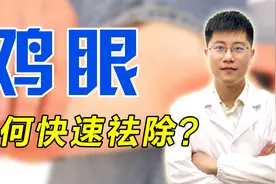 鸡眼反复出现怎么办？中医教你一个小妙招，教你轻松除鸡眼！视频封面