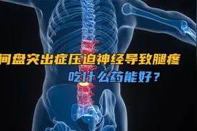 腰椎间盘突出症，压迫神经导致腿疼，吃什么药能好？视频封面