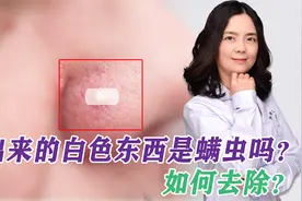 鼻子上挤出来的白色丝状物，到底是啥？皮肤医生教你3招祛除视频封面