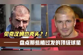 贝克汉姆也秃头？！盘点那些植过发的顶级球星视频封面