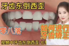 医学演绎 人体牙齿不整齐东歪西倒 如何进行有效的牙齿矫正视频封面