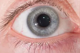 眼睛里出现红血丝，离不开这个因素,快速消除做好两件事就行视频封面