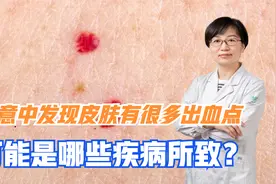 无意中发现皮肤有很多出血点，可能是哪些疾病所致？医生仔细讲解视频封面