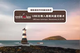 UBE右侧入路椎间盘切除术视频封面