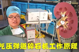肾结石手术使用的医疗设备气压弹道碎石机，设计很巧妙，看着都疼
