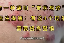有一种痛叫“带状疱疹”，医生提醒：有这4个现象，需要提高警惕视频封面