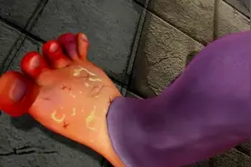 熊出没：强哥的脚踩到三角钉，得了破伤风变得又红又肿！