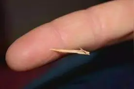 手指扎刺怎么办？用这招，不用针挑，让它自己跑出来，很厉害！视频封面