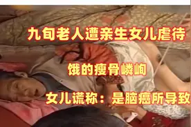 九旬老人遭亲生女儿虐待，饿的瘦骨嶙峋，女儿谎称：脑癌所导致视频封面