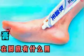 睡觉前在脚底抹点牙膏，作用真是厉害，好多人不懂有啥用，快看看视频封面