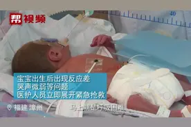 仅巴掌大！出生900克的男婴奇迹存活
