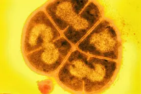 超强细菌被发现，能在太空中存活3年，或能佐证外星生命遍布宇宙视频封面