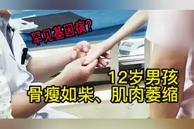 12岁男孩骨瘦如柴竟是罕见基因病？脊柱侧弯手术也困难重重