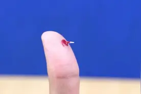 一个钥匙就可以解决扎在肉里的小刺，这方法太简单了视频封面