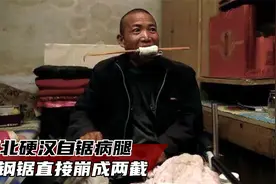 河北硬汉自锯病腿，全程不使用麻药，因剧痛咬坏3颗槽牙！纪录片视频封面