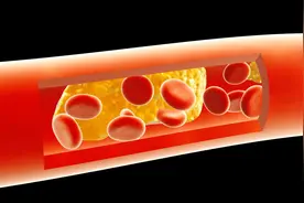 静脉血栓是血液凝固了，那可以热敷通一通吗？医生讲静脉血栓处理