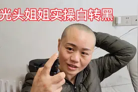 光头是怎么护理头皮的,怎样才能让白发转黑,看一下她的操作方法视频封面