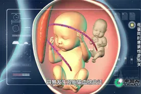 产妇的两个孩子是共用胎盘的双胞胎，并且发生了双胎输血综合症视频封面