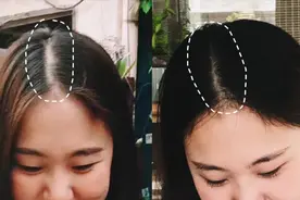 生姜用完真的能生发？看完使用结果，惊不惊喜！意不意外？