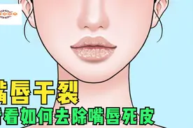 美女嘴唇干裂脱皮，整个死皮像一片片薯片，来看看正确的处理方式视频封面